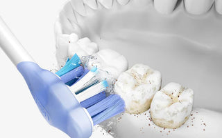 Best Electric Toothbrush for Plaque Removal? What Actually Matters in 2026